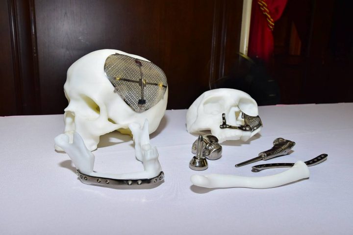 samples of skulls, faces, jaws, and titanium bones produced with 3D printing technology
