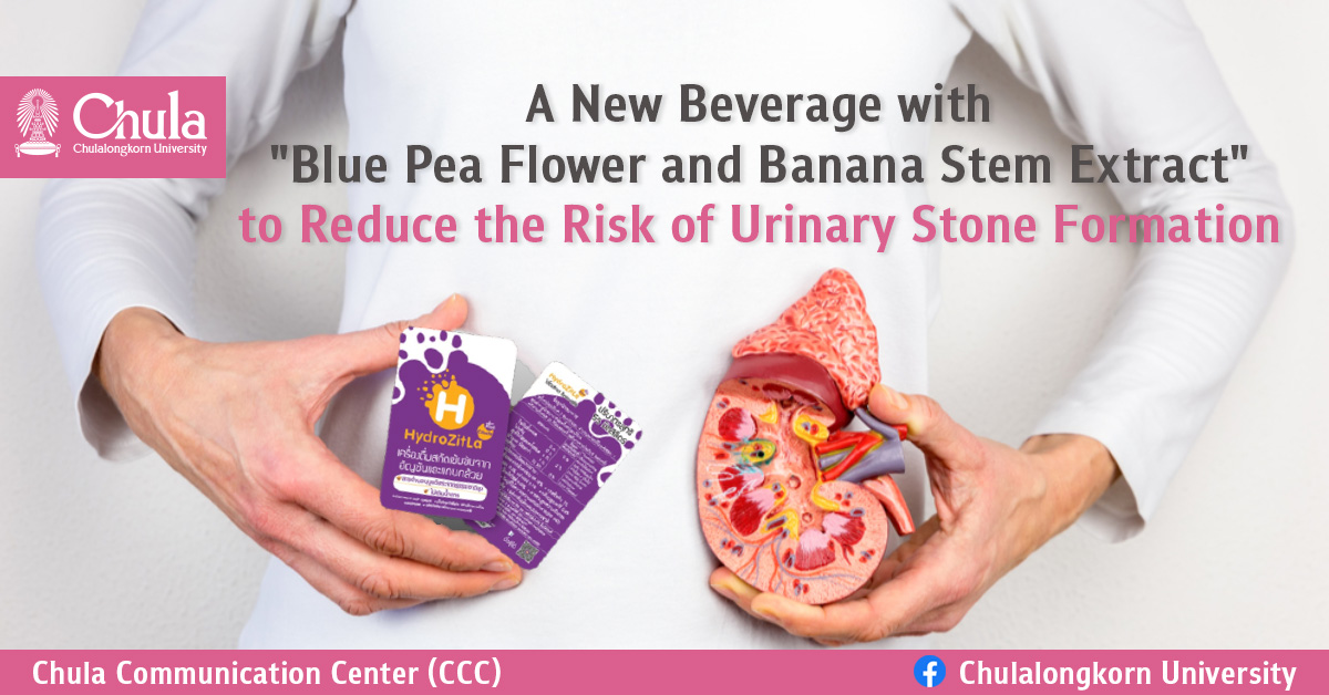"Blue Pea Flower and Banana Stem Extract" to Reduce the Risk of Urinary Stone Formation
