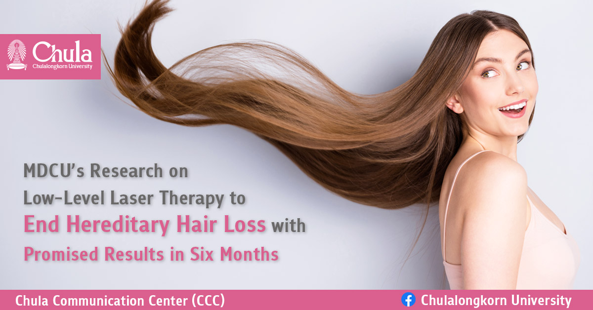 MDCU's Research on Low-Level Laser Therapy to End Hereditary Hair Loss with  Promised Results in Six Months – Chulalongkorn University