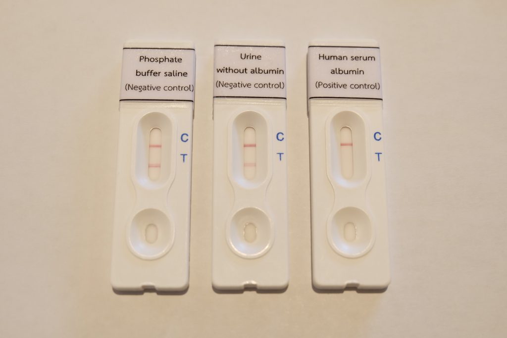 Kidney disease self-examination kit