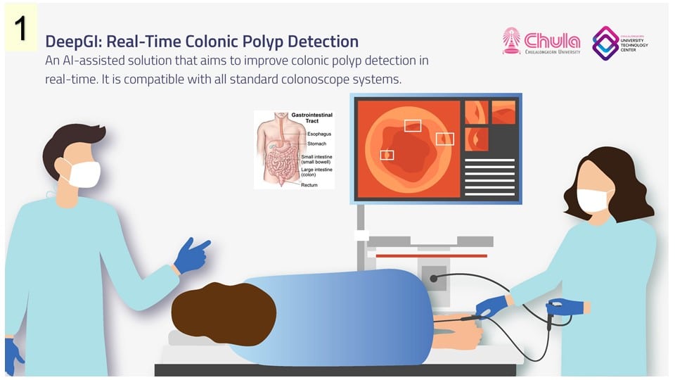 Gastrointestinal endoscopy procedure