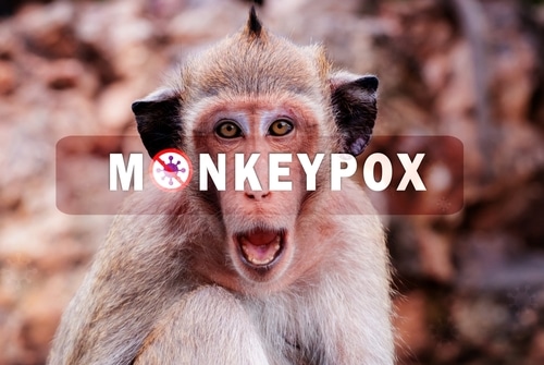 Monkeypox