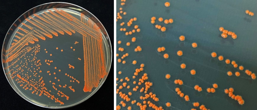 Samples of oil-eating bacteria