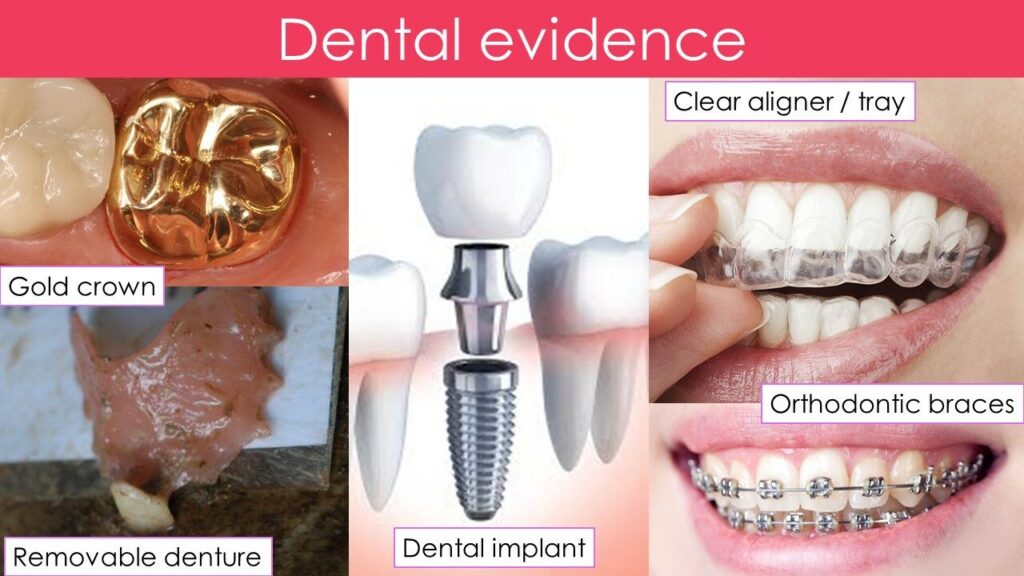 หลักฐานทางทันตกรรม