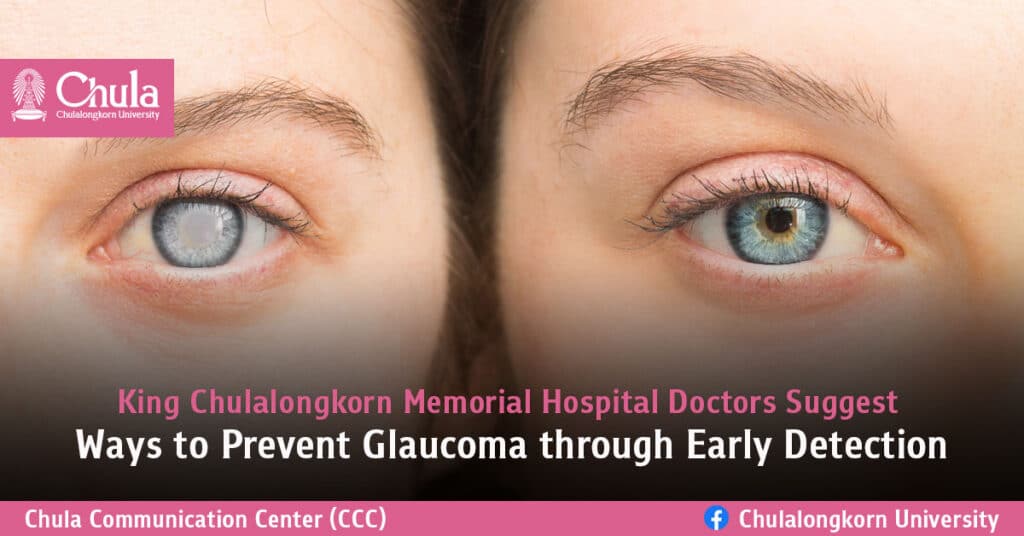 Ways-to-Prevent-Glaucoma-through-Early-Detection