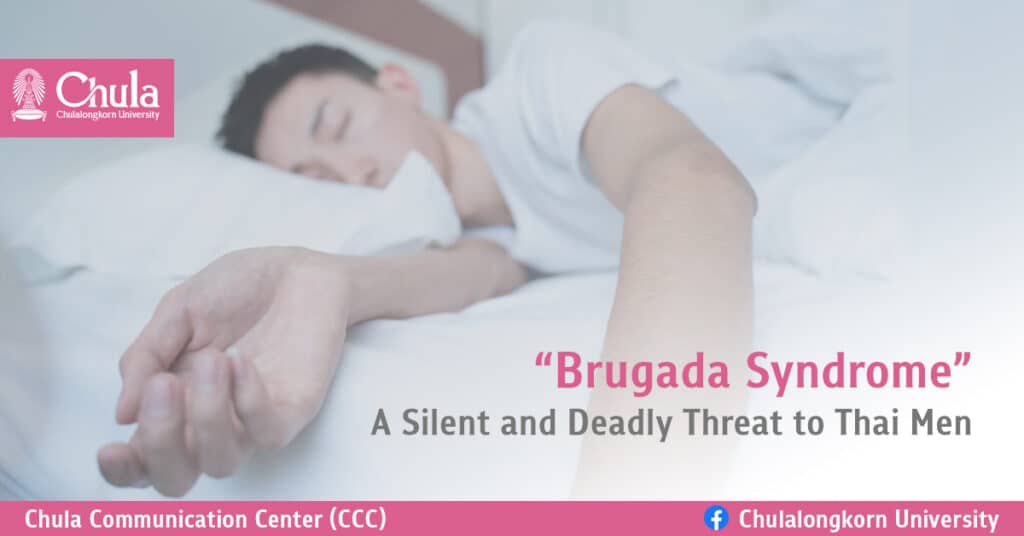 Brugada Syndrome - A Silent and Deadly Threat to Thai Men