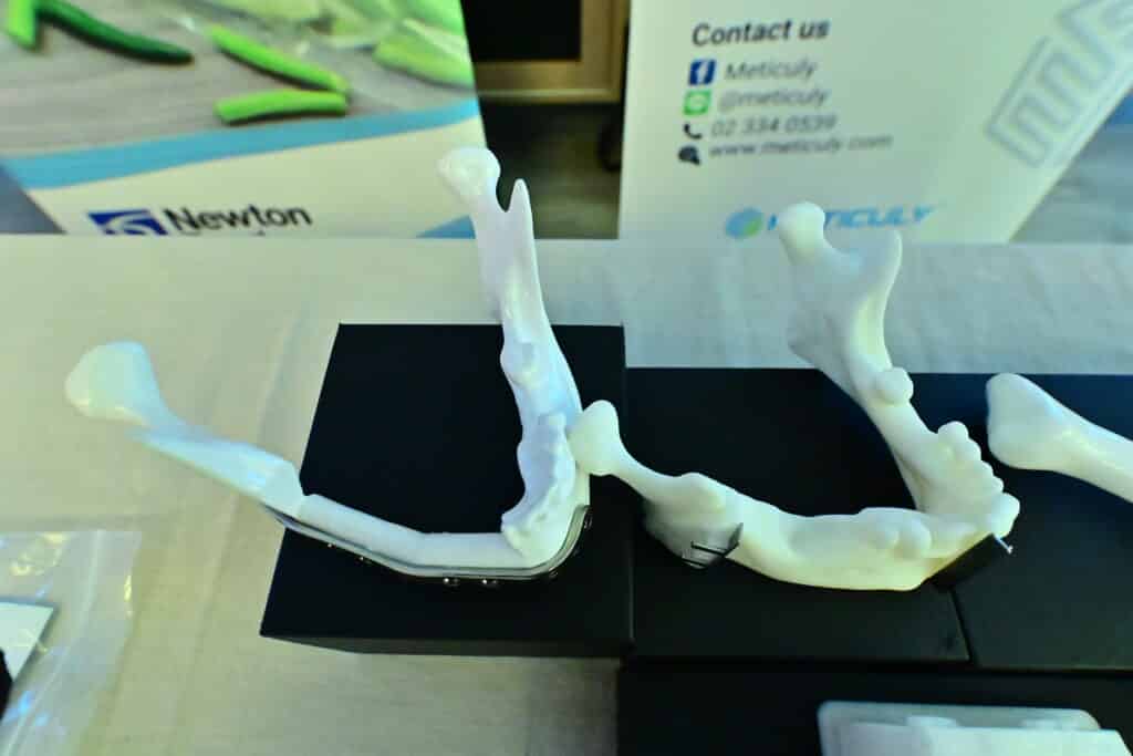 Artificial skulls, faces, and jaws with 3D printing technology