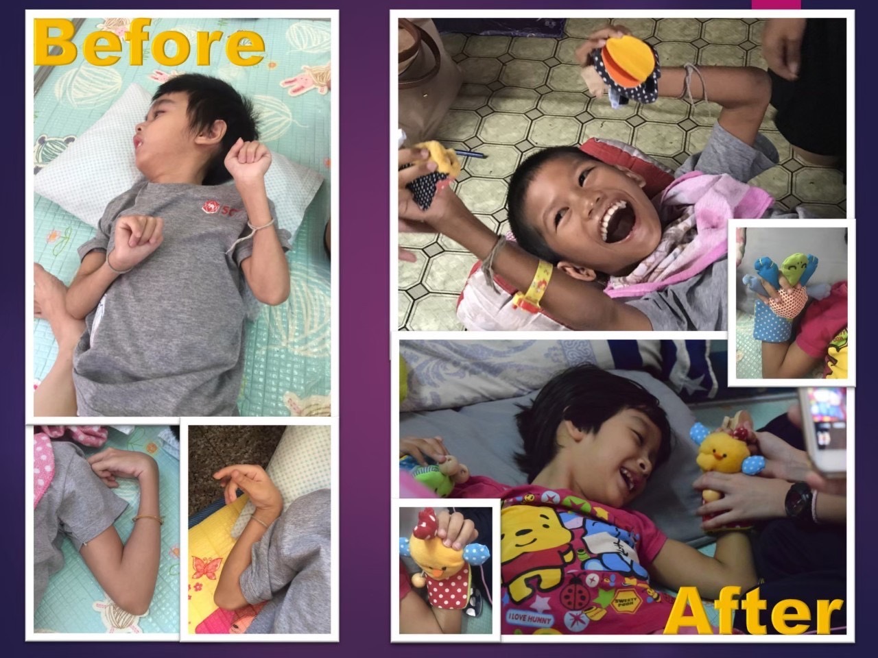 Happy CP Gloves by Satit Chula Demonstration Students Win First Prize in Student Innovation Contest for People with Disabilities and the Elderly