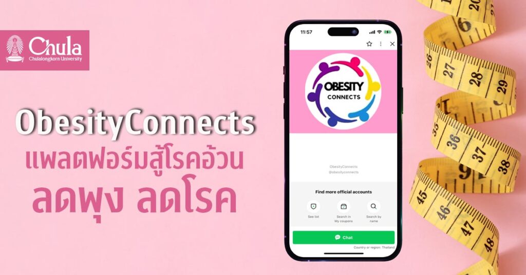 ObesityConnects]ลดพุง ลดโรค คุมน้ำหนัก