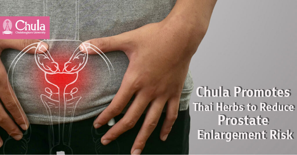 Thai Herbs “Crinum Plants – Black Galingale”: A New Alternative to Reduce the Risk of Prostate Enlargement by Chula Research Team 