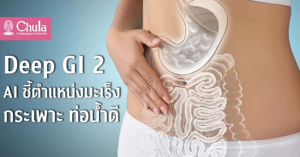 Deep GI AI ตรวจหามะเร็งกระเพาะ ท่อน้้ำดี ทางเดินอาหาร